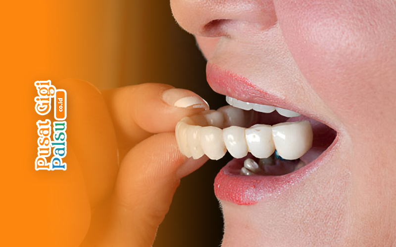 artikel pusat gigi palsu 1